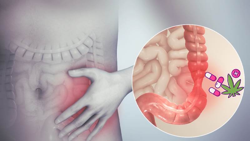 Should gastroenterologists prescribe cannabis? The highs, the lows and the unknowns. World J Clin Cases. 2023