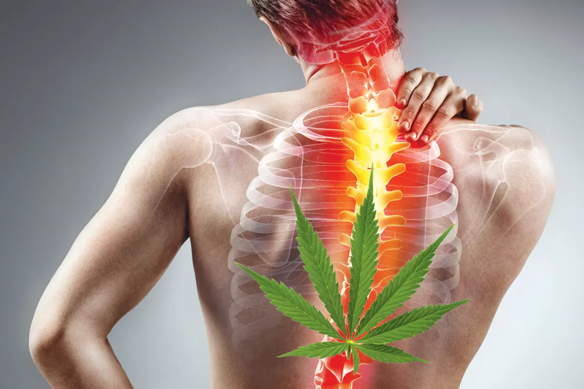 Is Cannabis Effective in the Treatment of Chronic Back Pain? Cureus. 2023